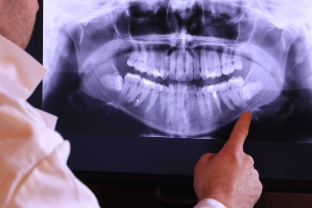 Best Emergency Treatment for Jaw Pain or Injury in Montgomery, OH