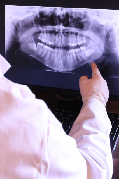 Best Knocked-Out Tooth (Avulsed Tooth) Treatment in Montgomery, OH