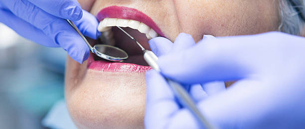 Best Emergency Treatment for Oral Infections in Montgomery, OH